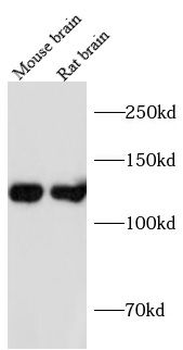 NTRK1 Antibody
