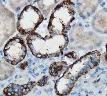 HGF Antibody