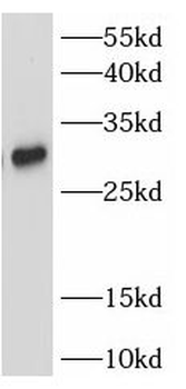 TIGIT Rabbit Polyclonal Antibody