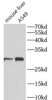 SLC31A1 Antibody