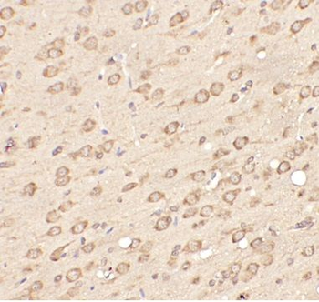 OPRM1 Antibody