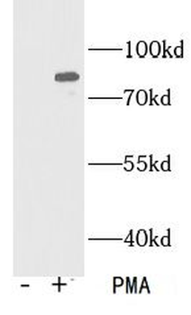 Phospho-pan PKC (T410) Antibody