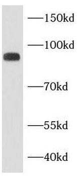 ADAM10 Rabbit Polyclonal Antibody