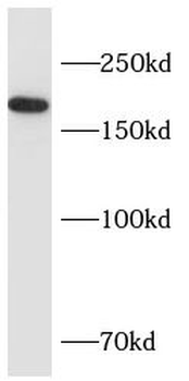 CFTR Antibody