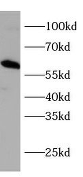 CDKN1C Antibody