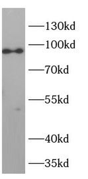 PMS1 Rabbit Polyclonal Antibody