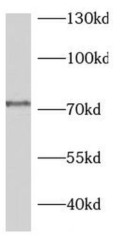 PWWP3A Antibody