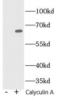 Phospho-NF-kB p65 (S536) Antibody
