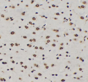 Phospho-NF-kB p65 (S536) Antibody