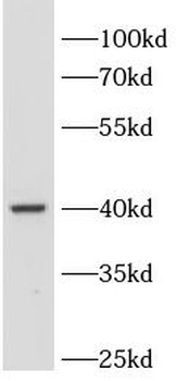 PDX1 Rabbit Polyclonal Antibody