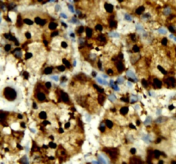 ANXA1 Antibody