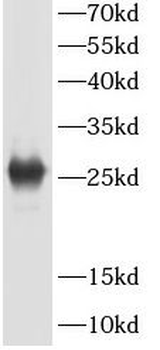 IgG kappa Light Chain Rabbit Polyclonal Antibody