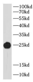 IgG Lambda Light Chain Rabbit Polyclonal Antibody