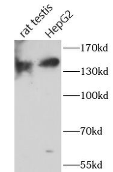 DENND2B Antibody