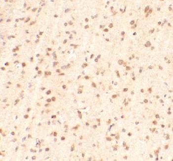 METTL14 Antibody