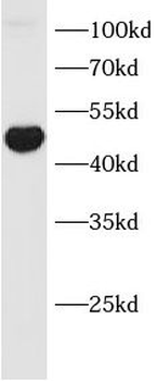 GATA3 Mouse Monoclonal Antibody