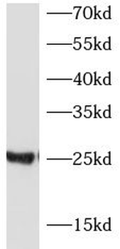 CSN2 Antibody