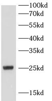 MT-ATP6 Antibody