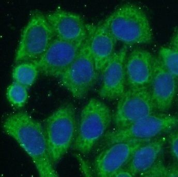 NOD2 Rabbit Polyclonal Antibody