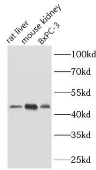 NEU1 Rabbit Polyclonal Antibody