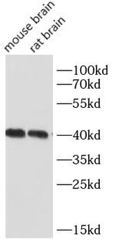 NDRG2 Mouse Monoclonal Antibody