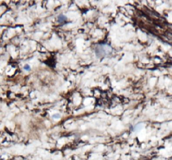 NDRG2 Antibody