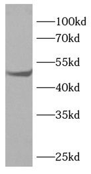 HNF4A Rabbit Polyclonal Antibody