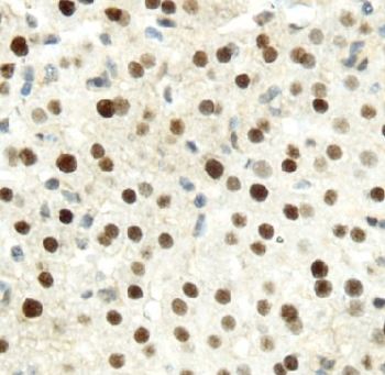 HNF4A Rabbit Polyclonal Antibody