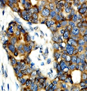 PGAM5 Antibody