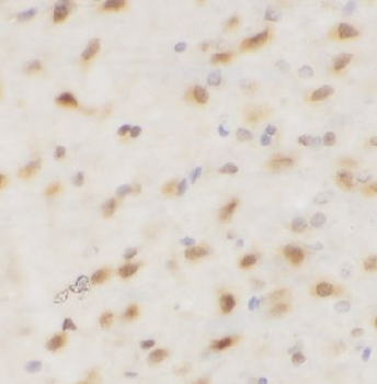 Phospho-c-Jun(S73) Antibody