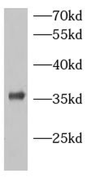 BDNF Mouse Monoclonal Antibody