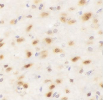 SOX9 Rabbit Polyclonal Antibody