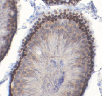 HOXA10 Antibody