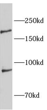 SLC4A10 Rabbit Polyclonal Antibody