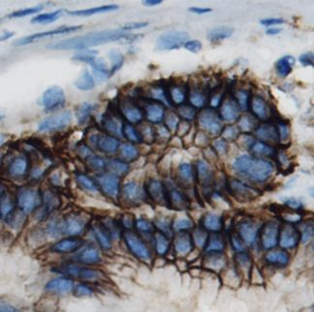 SLC1A5 Antibody