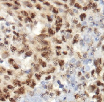 RAD50 Antibody