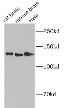 IPO7 Rabbit Polyclonal Antibody