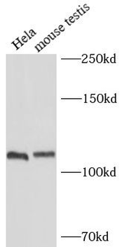 RAD54B Rabbit Polyclonal Antibody