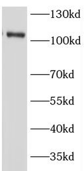 OSBPL3 Antibody
