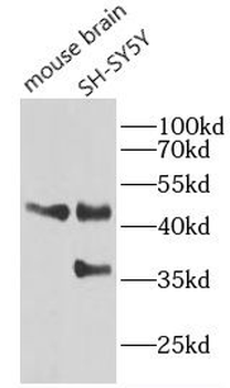 EGLN1 Mouse Monoclonal Antibody