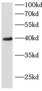 TREM2 Rabbit Polyclonal Antibody
