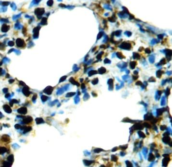 GLI1 Antibody