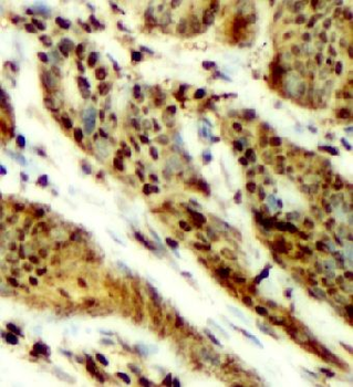 THRB Rabbit Polyclonal Antibody
