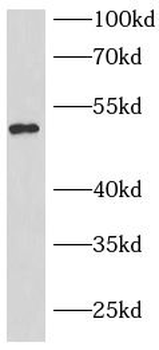 mCherry Antibody