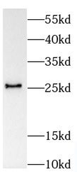 SPC24 Antibody