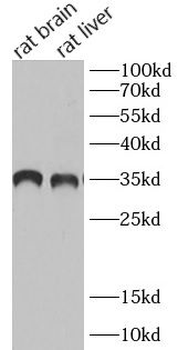 GDNF Rabbit Polyclonal Antibody