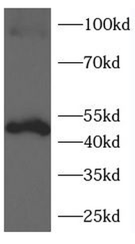 GSDMD-N Antibody