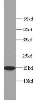 EIF4EBP1 Antibody
