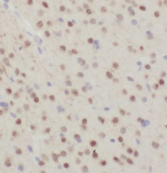 NCEH1 Antibody