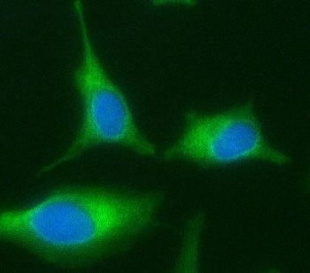 ABCD1 Antibody
